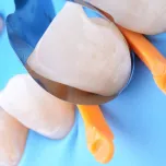 Polydentia Unica Anterior Intro Kit