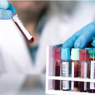 Bruker IVDr-Platform BioBank Tool