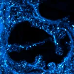 Global Slime Mould Migration