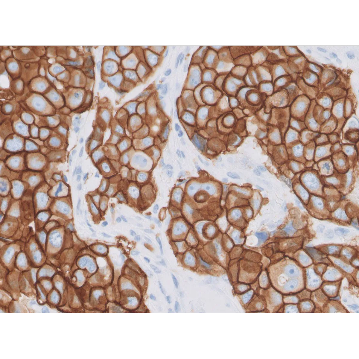 HercepTest™ mAb pharmDx