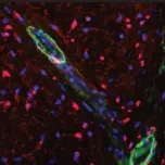 Angiogenesis in vitro to in vivo toolbox