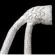 GORE® EXCLUDER® Conformable AAA Endoprosthesis with ACTIVE CONTROL System