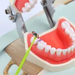 Dental Sectional Contoured Matrices Kits