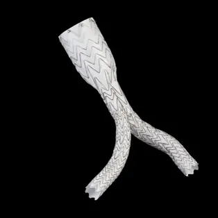 GORE® EXCLUDER® AAA Endoprosthesis