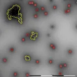 QuTEM - Adenoviral vector analysis
