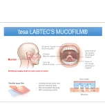 Mucoadhesive film technology