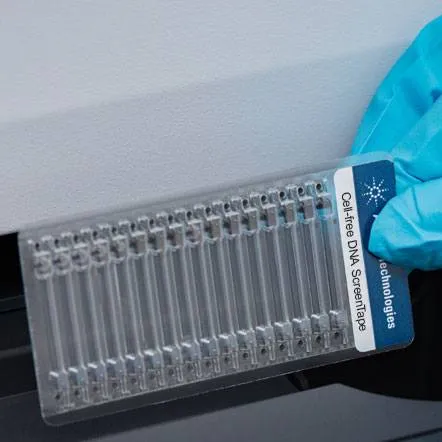 Cell-free DNA ScreenTape Analysis