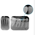 Durr VistaScan MiniView