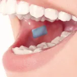 Mucoadhesive film technology