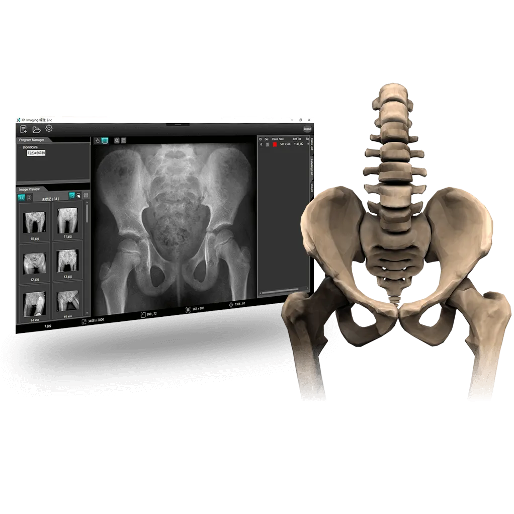 Biomedica X1 A1 Bone Densitometer Solution
