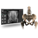 Biomedica X1 A1 Bone Densitometer Solution