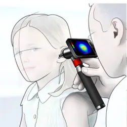 3D tympanoscoop as novel instrument for real-time analysis of eardrum deformations