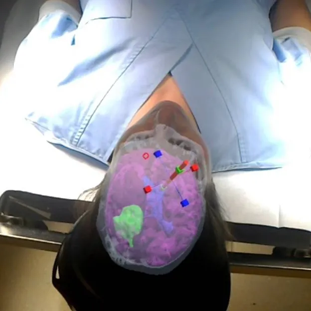 FLT imaging using Nanobodies - effective tool for life sciences and medical applications (NLITE)