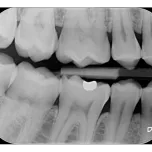 Durr VistaScan MiniView