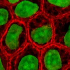 Cell lines and hybridoma's