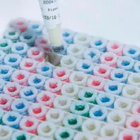 Biomarker discovery & IP opportunities