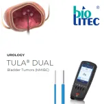 Leonardo® DusterTFL and Leonardo® Mini Dual diode laser, Urology Laser