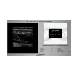 BLOCKSIM™ – Simulator for ultrasound-guided fascia blocks