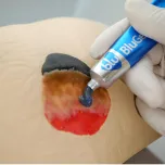 Blu® Smart Advanced Wound Dressings