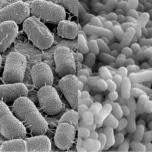 A Companion Solution for GLP-1 Agonist!, MyoGastro™