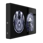 DICOM Viewer 55'' station - PACS Consultation viewing monitor
