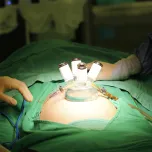 LAGIS Single Port Acess