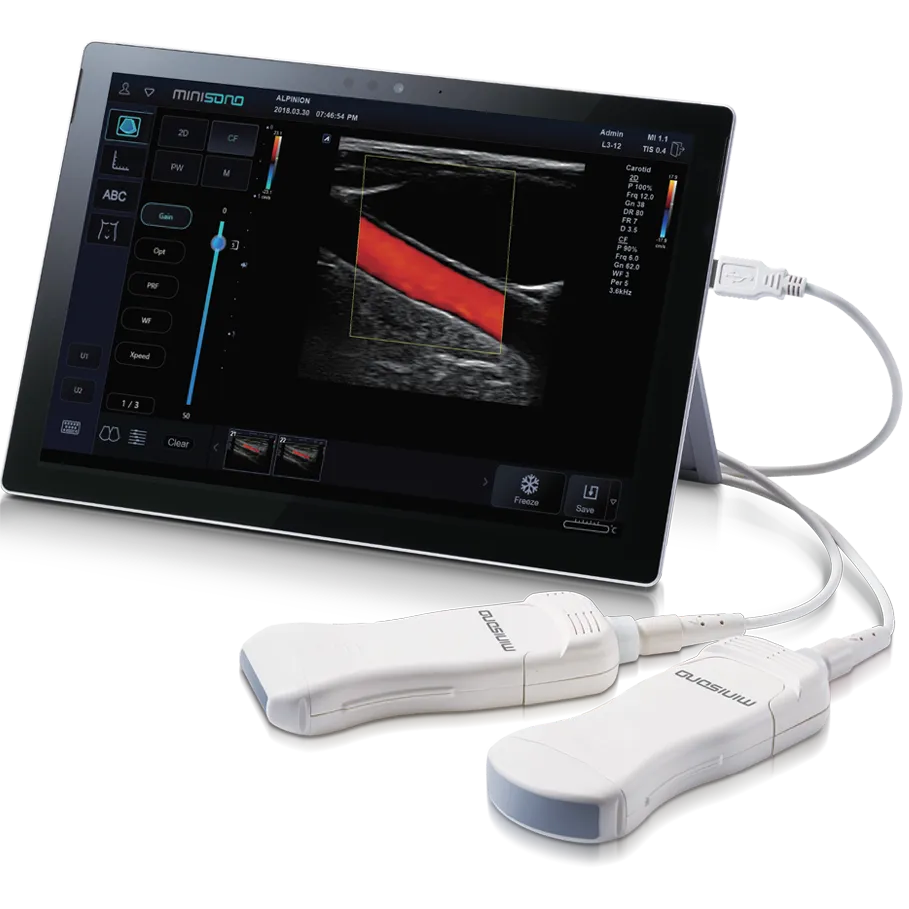 Minisono: The Next Generation of Portable Ultrasound
