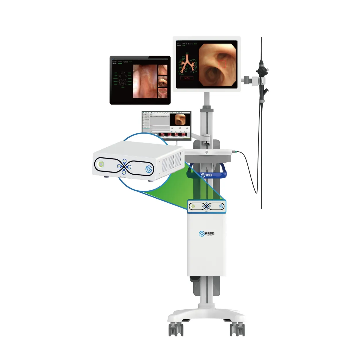 AI Respiratory Tract Endoscopy System