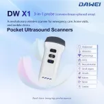 Diagnostic Ultrasound Device