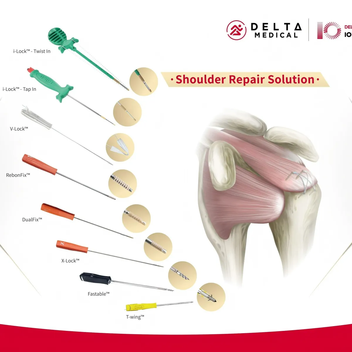 Shoulder Repair Solution