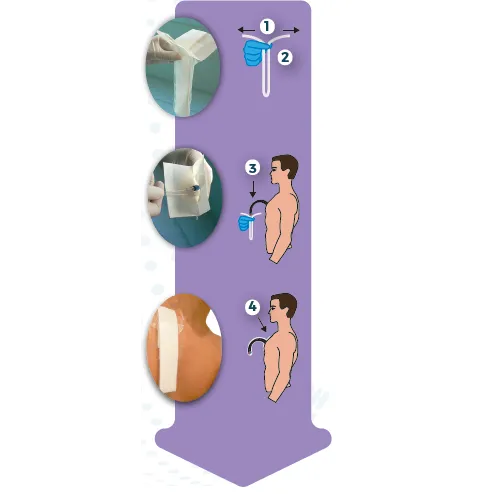 Hypoallergenic Central catheter protection dressing