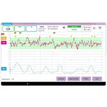 Fetal Lite NST-CTG Next-gen AI Powered Fetal Monitoring System