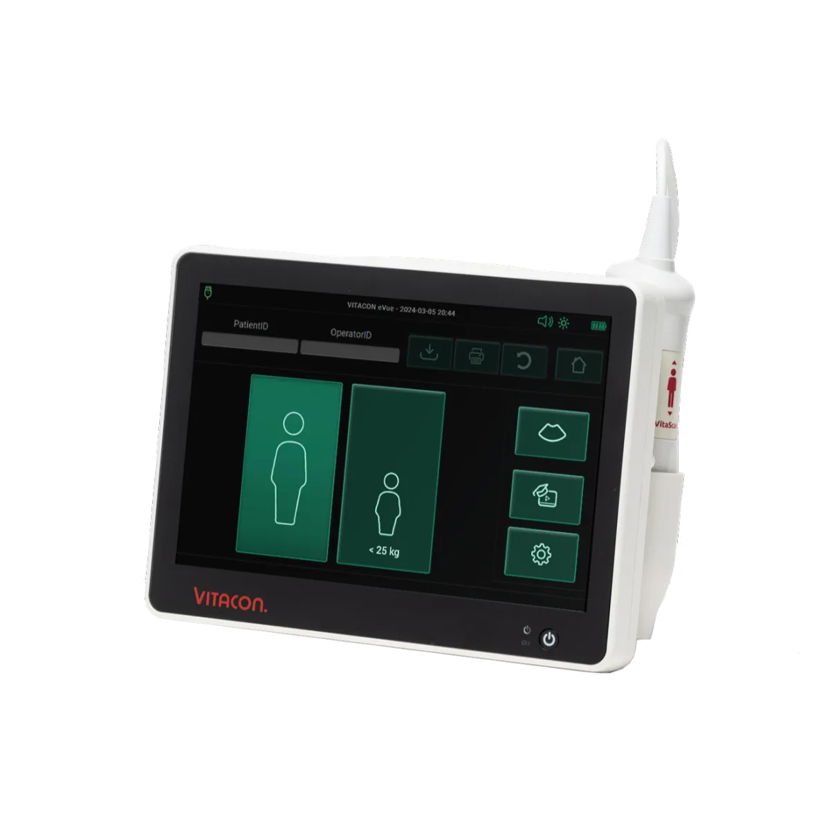 Vitascan eVue Bladder Scanner