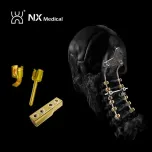 Orthopedic Implant for Spine