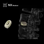 Orthopedic Implant for Spine