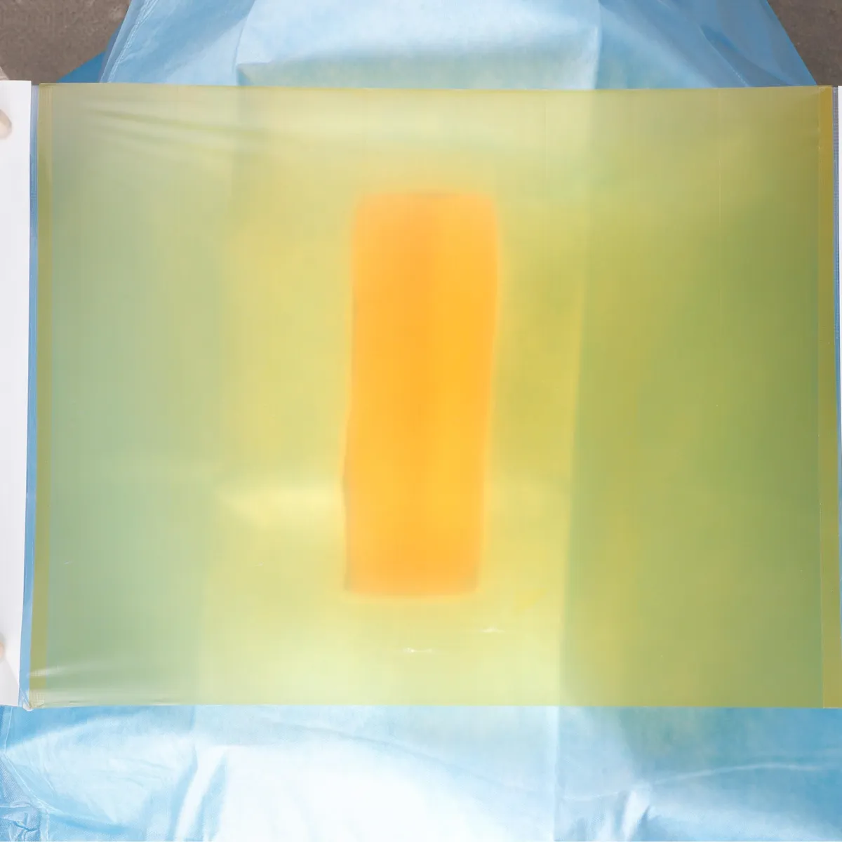 Surgical incise drape, iodine incise drape, antimicrobial incise drape