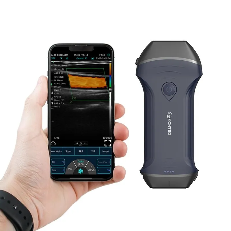 C10XLpro Dual-Probes Multipurpose Ultrasound Phased + Linear Probe