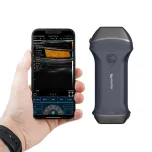 C10XLpro Dual-Probes Multipurpose Ultrasound Phased + Linear Probe
