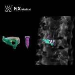 Orthopedic Implant for Spine