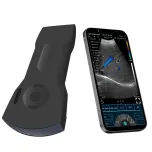 C10XS 3 in 1 Dual-Probes Multipurpose Ultrasound Convex +Linear Probe