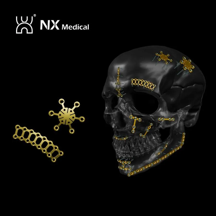 Orthopedic Implant for Trauma