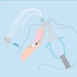 VapCare - World's First Intelligent Oral Hygiene Management System for Ventilated Patients