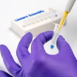 Lodestar DX UTI testing system