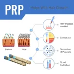 PRP Tube-10ml