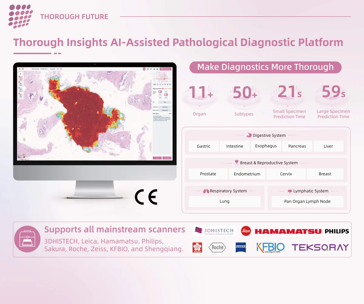 Thorough Insights Platform