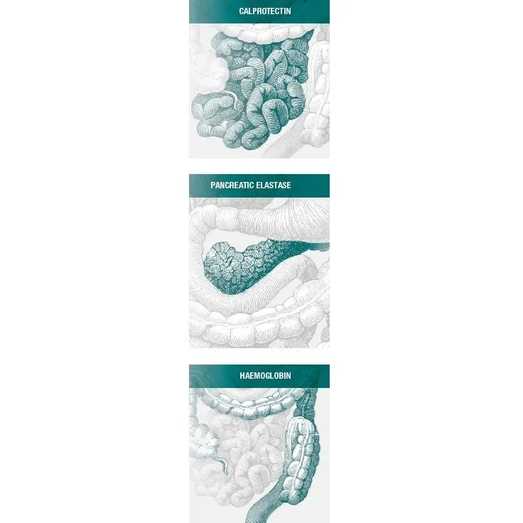Turbidimetric Tests for Gastroenterology Diseases