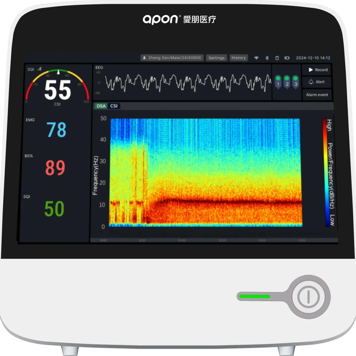 Anesthesia Depth Monitor
