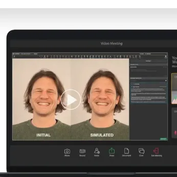 Invisalign Smile Video
