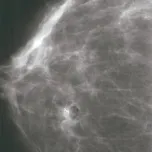 Mamawire Fix D Breast Clip Marker