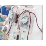Dialysis